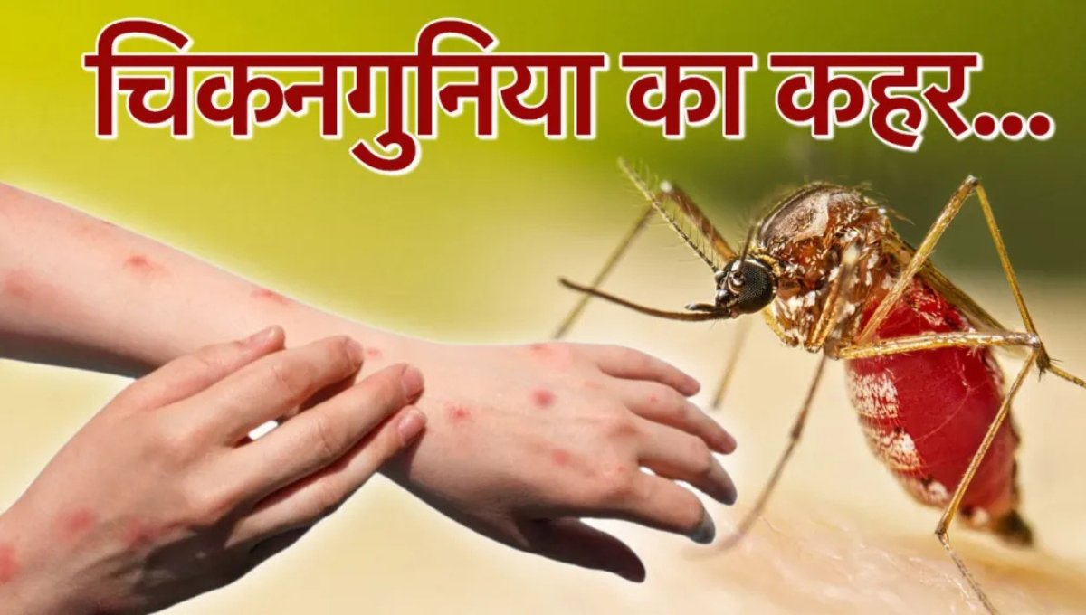 Chikungunya